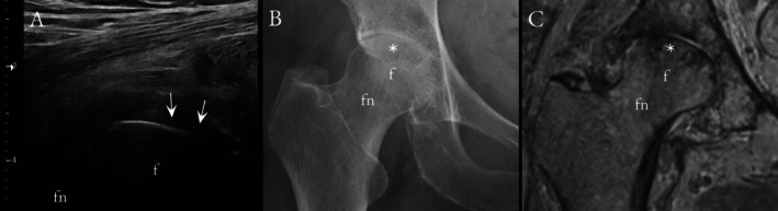 FIGURE 4