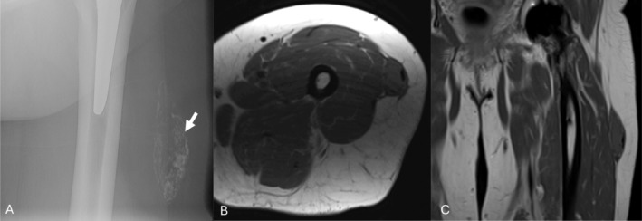 FIGURE 2
