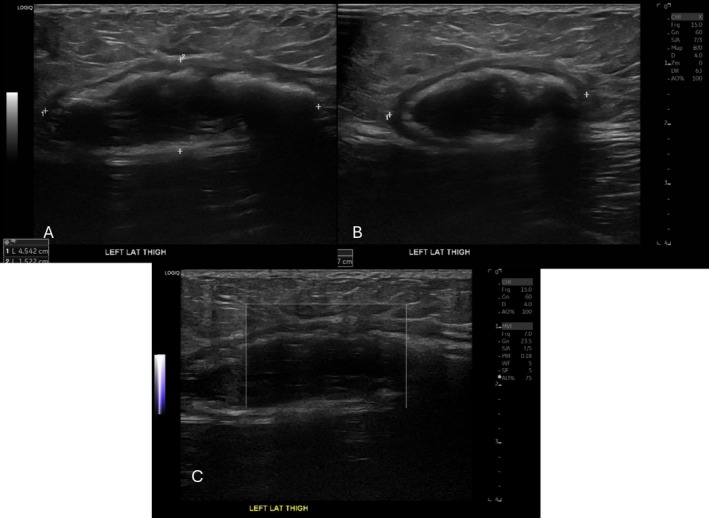 FIGURE 3