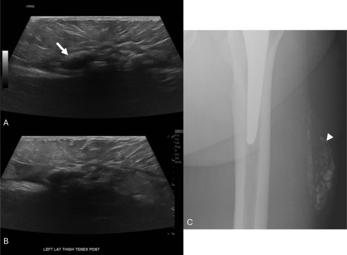 FIGURE 5