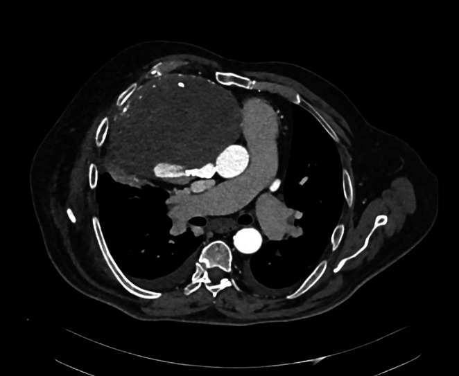 FIGURE 4