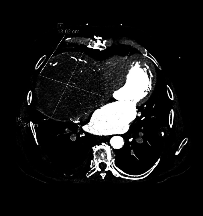 FIGURE 5