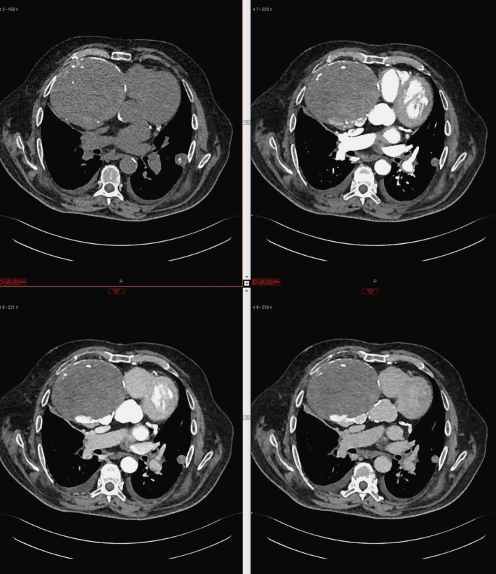 FIGURE 2