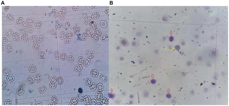 Figure 11