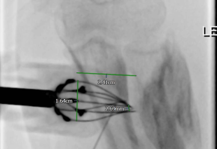 Figure 6
