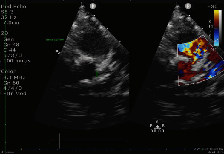 Figure 2