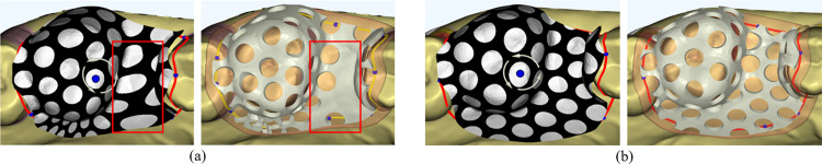 Fig 11