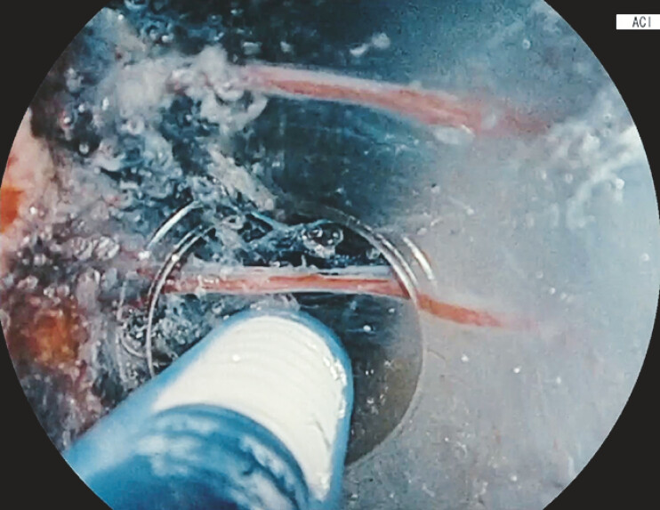 Fig. 3