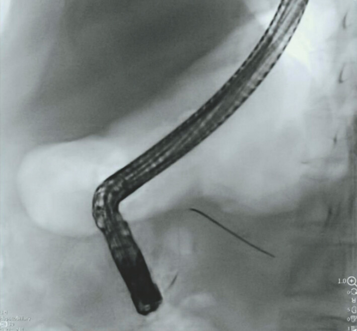 Fig. 1