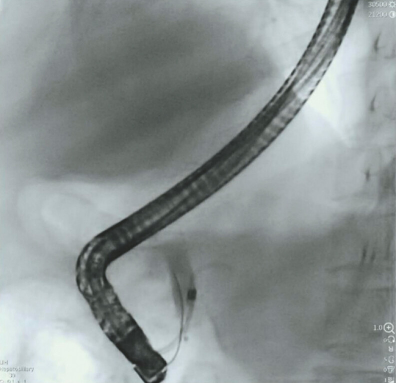 Fig. 2