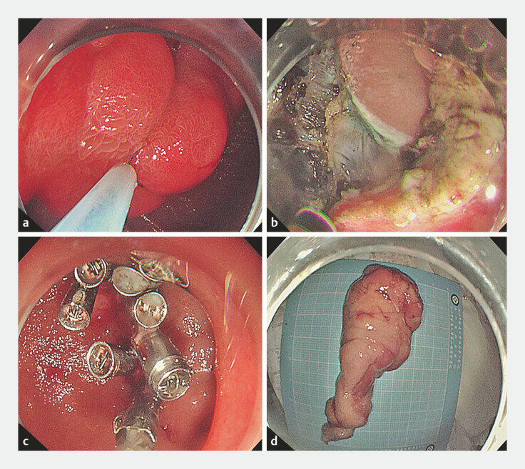 Fig. 4