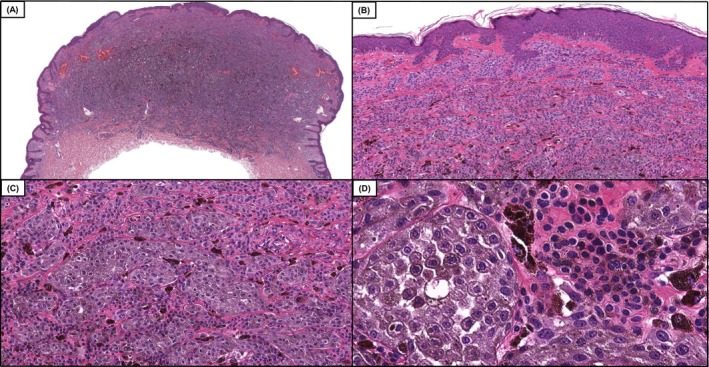 FIGURE 1