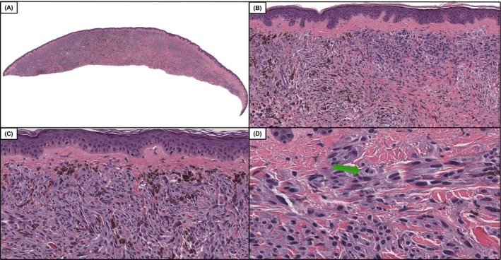 FIGURE 2