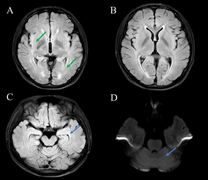 Figure 2