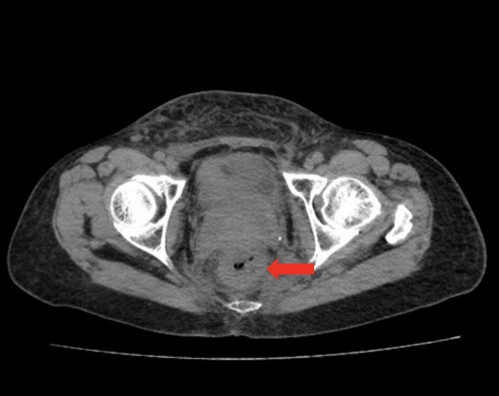 Figure 1