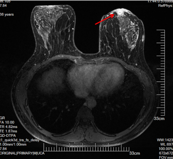Figure 2