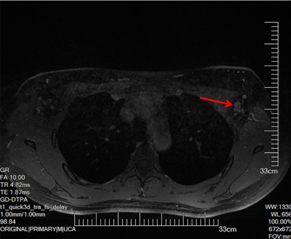 Figure 3