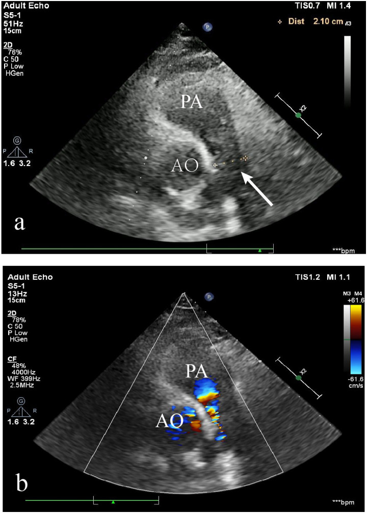 Figure 1