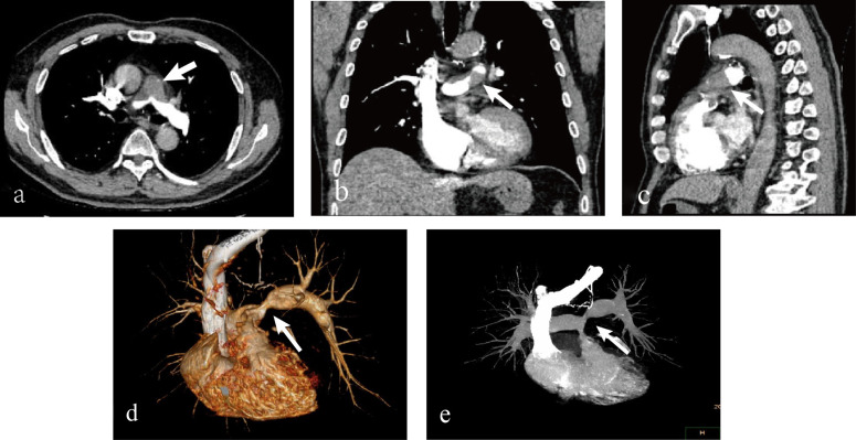 Figure 2