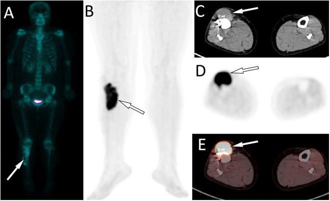 Figure 4