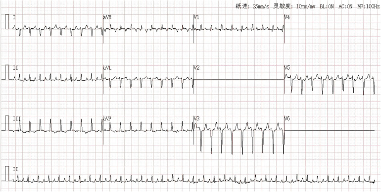 Figure 1