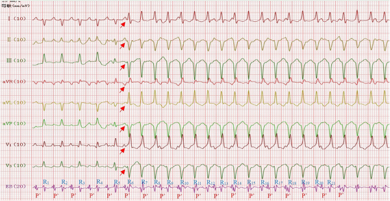 Figure 2