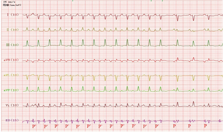 Figure 3