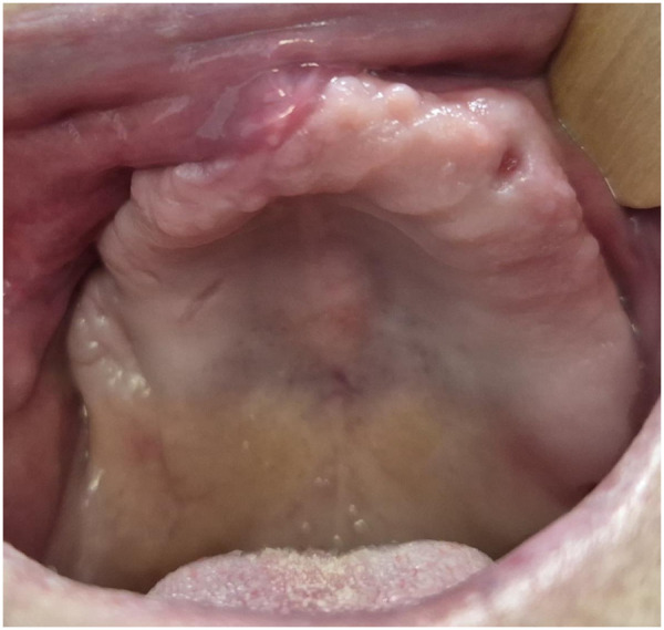 Figure 3