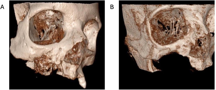 Figure 4
