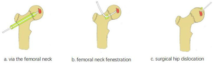 Figure 1