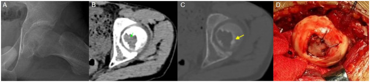 Figure 5