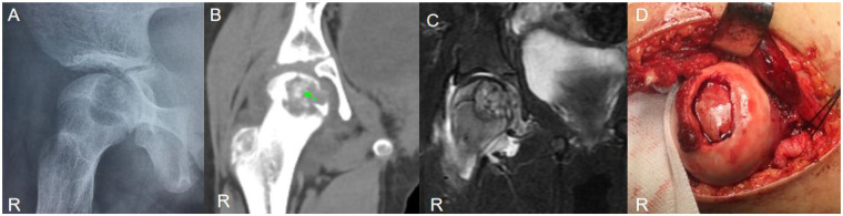 Figure 6