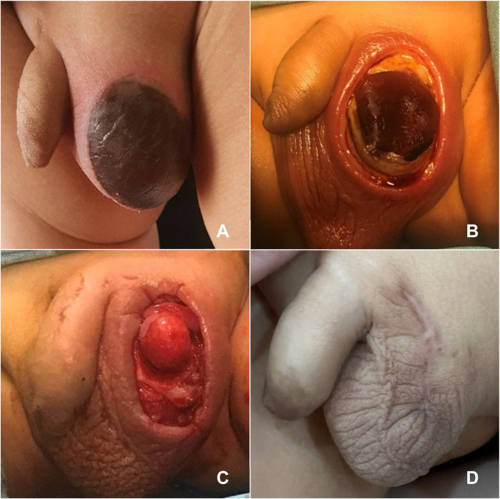Figure 1