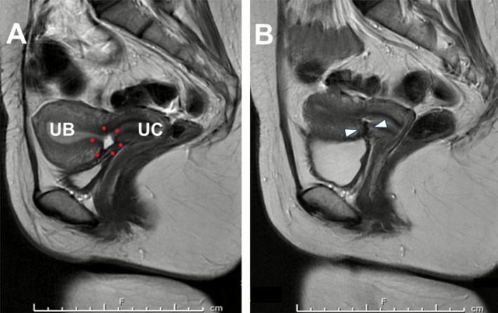 FIGURE 3