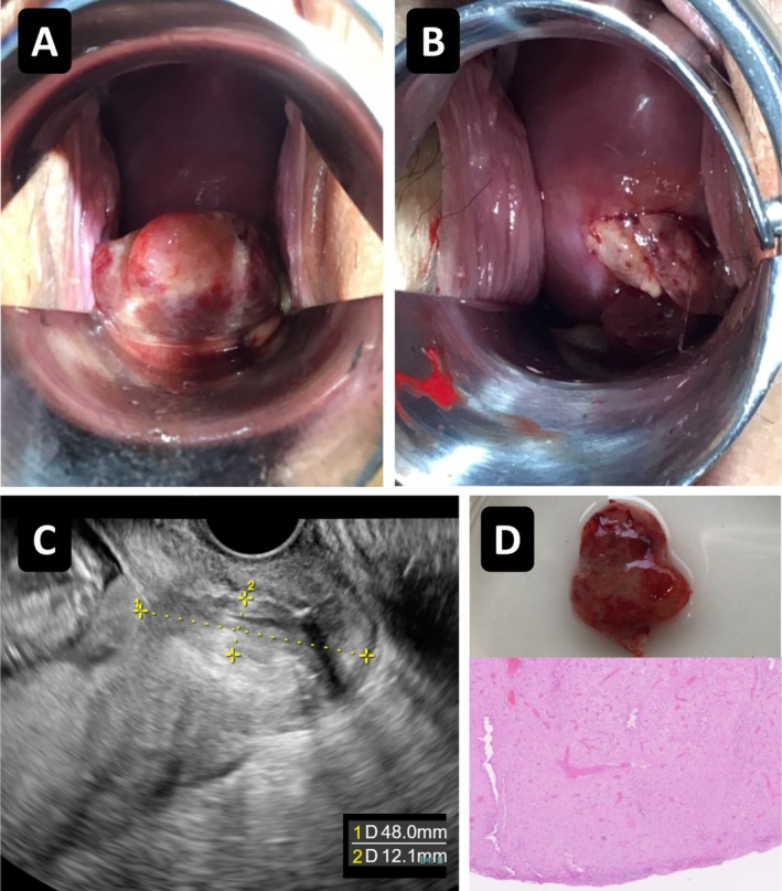 FIGURE 2