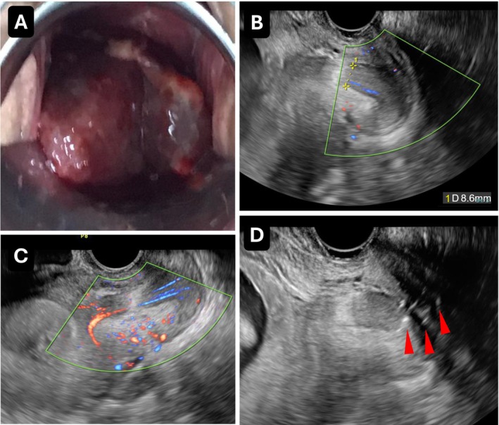 FIGURE 1