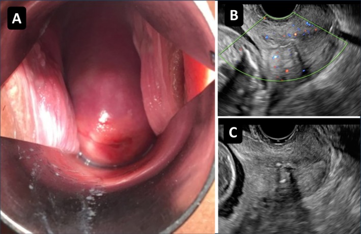 FIGURE 3