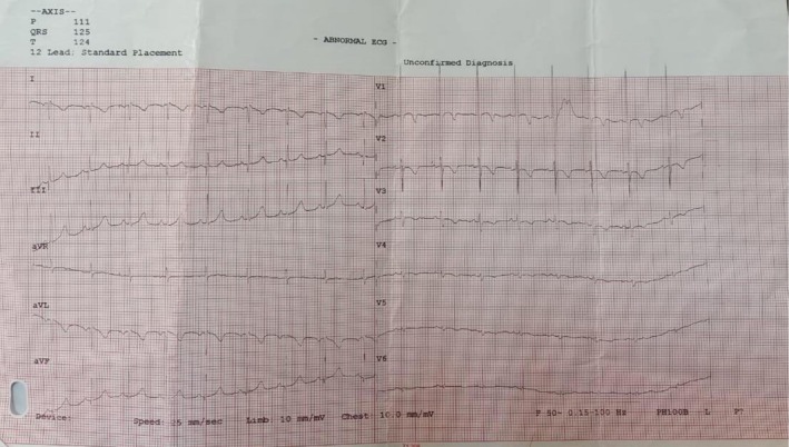 FIGURE 3