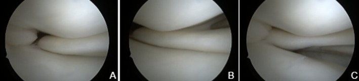 FIGURE 2