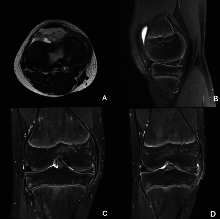 FIGURE 3