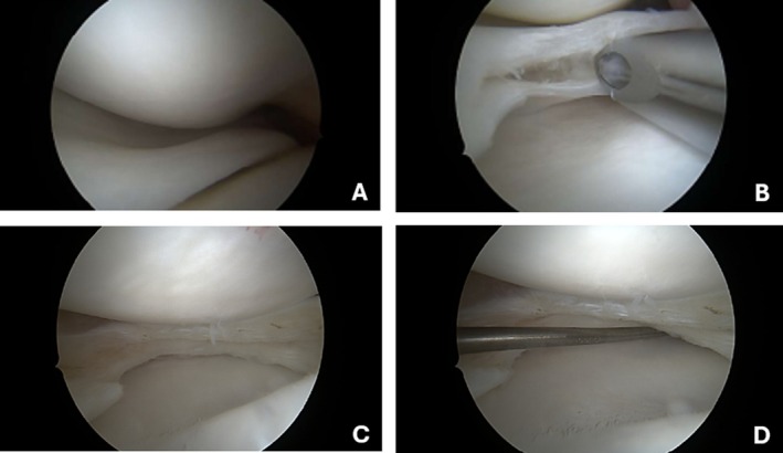 FIGURE 6