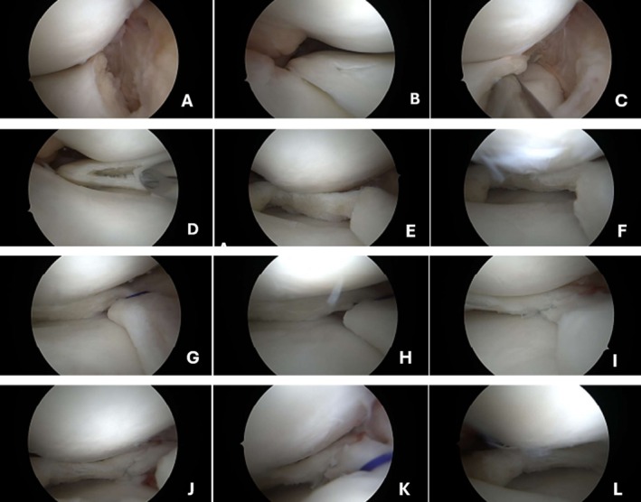 FIGURE 4