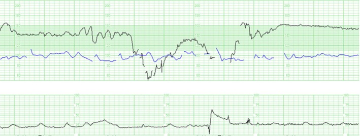 FIGURE 1