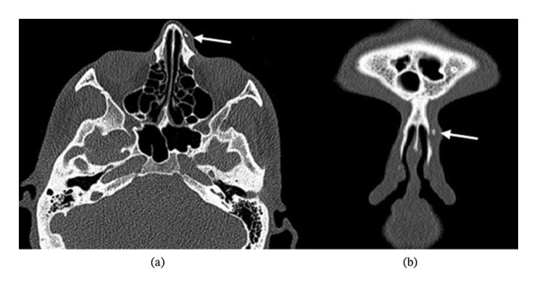 FIGURE 2