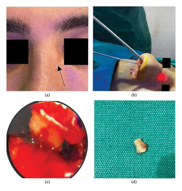 FIGURE 1