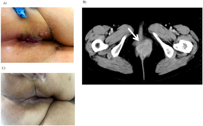 Figure 1