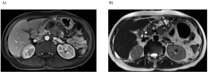 Figure 2