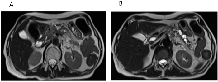 Figure 4