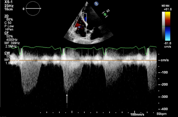 Figure 6