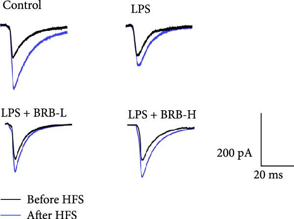 Figure 22